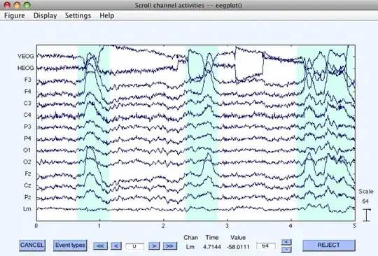 EEG artifacts